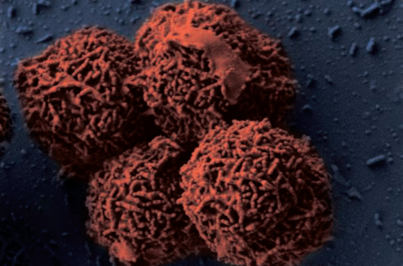 <i>Planococcus halocryophilus Or1</i>